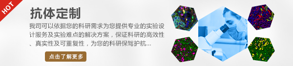 抗體定制